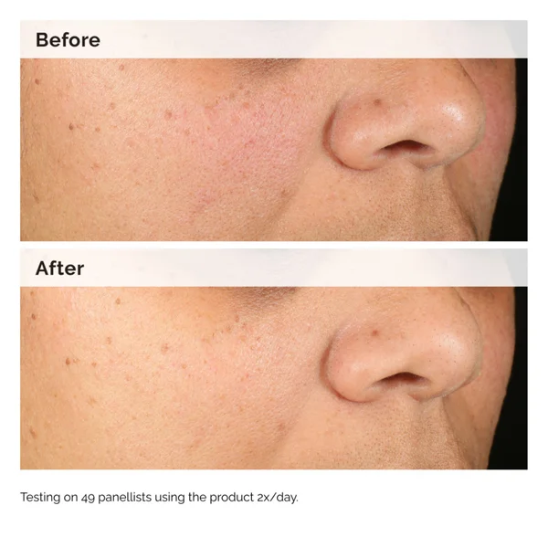 The Ordinary Alpha Arbutin 2% + HA 30ml