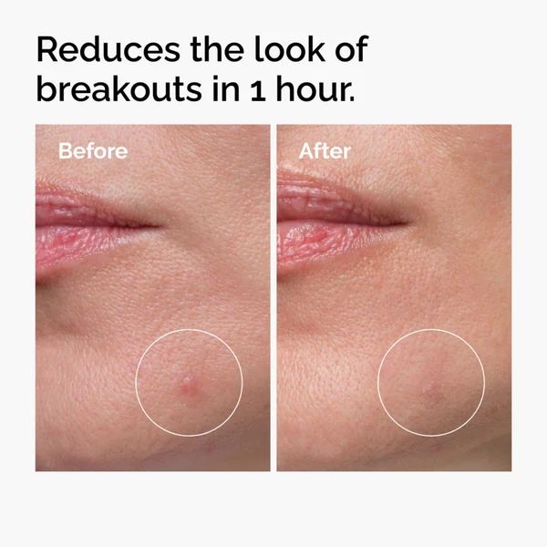 The Ordinary Sulfur 10% Powder-to-Cream Concentrate 5g