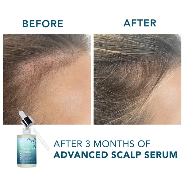 We Are Paradoxx Growth Advanced Scalp Serum