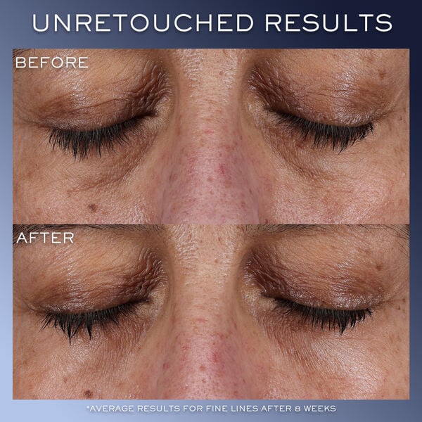 Lancôme Génifique Ultimate Eye Cream