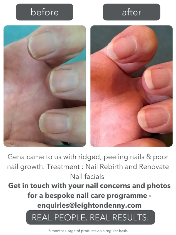 Leighton Denny Nail Transformation Kit SPECIAL VALUE