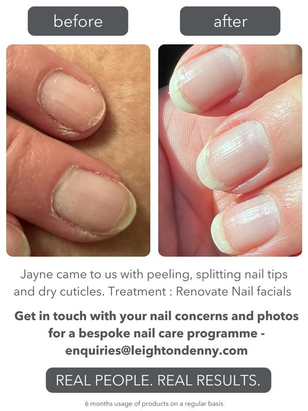 Leighton Denny Renovate Nail Facial Kit SPECIAL VALUE