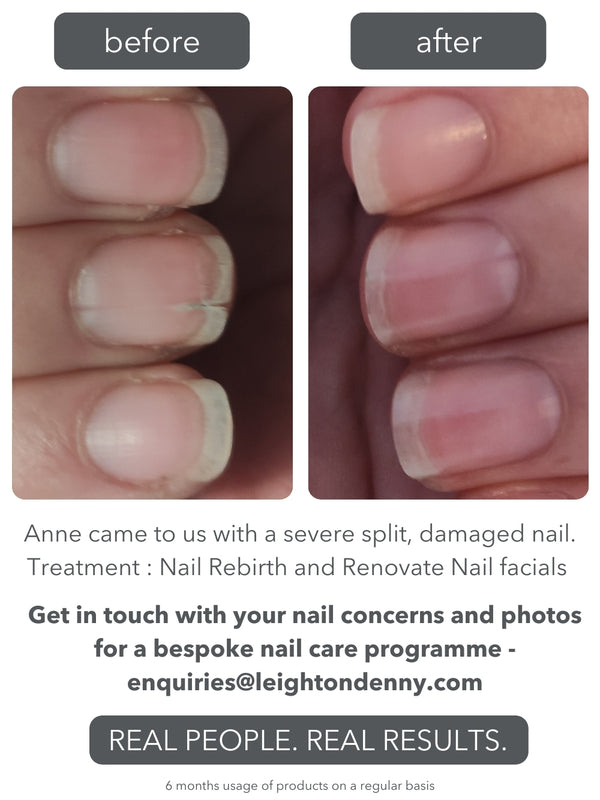 Leighton Denny Renovate Nail Facial Kit SPECIAL VALUE