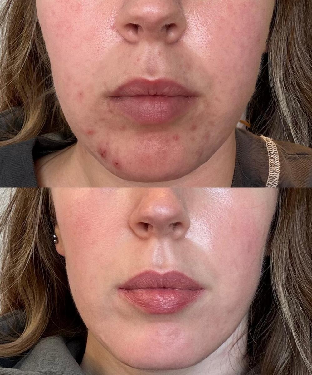 Liberty London Dr. David Jack Red Peel Breakout Control Mask