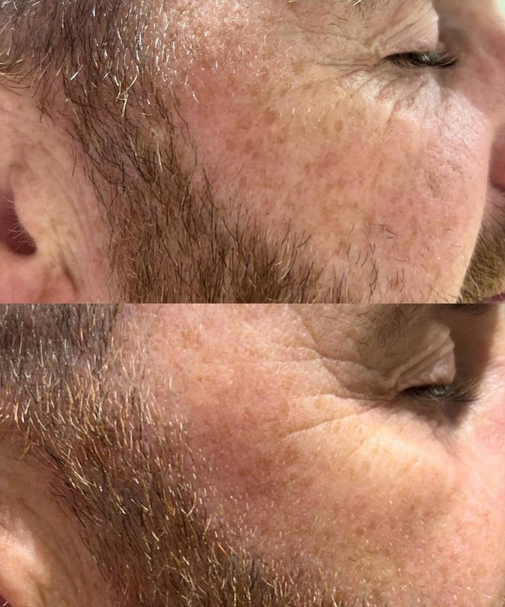 Liberty London Dr. David Jack Yellow Peel Pigment Correcting Mask Refill