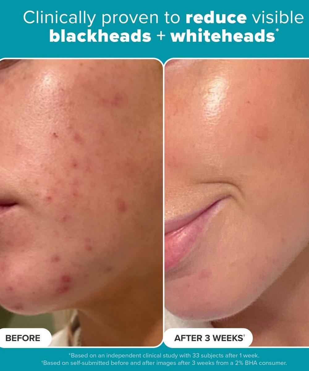 Liberty London Paula's Choice Skin Perfecting 2% BHA Exfoliating Pads