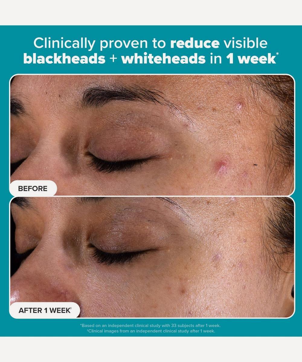 Liberty London Paula's Choice Skin Perfecting 2% BHA Exfoliating Pads