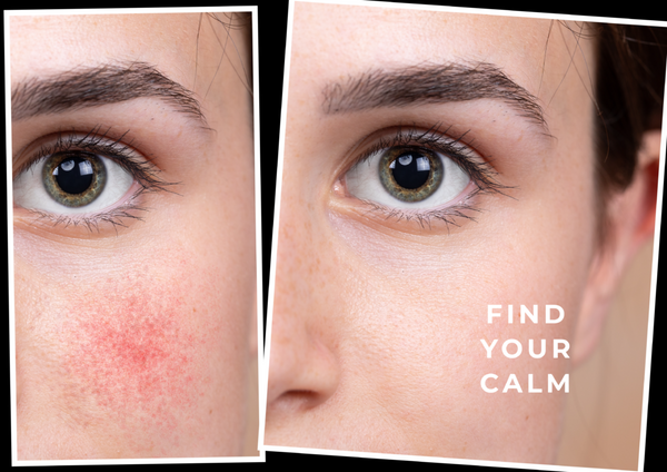 Lily Lolo CV Skinlabs Calming Moisture For Face Neck And Scalp