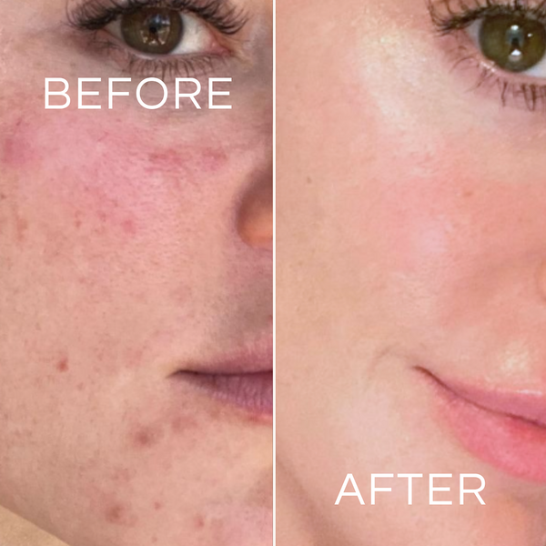 Lily Lolo Koa Life Vit-C Brightening Cleanser | 50 Ml