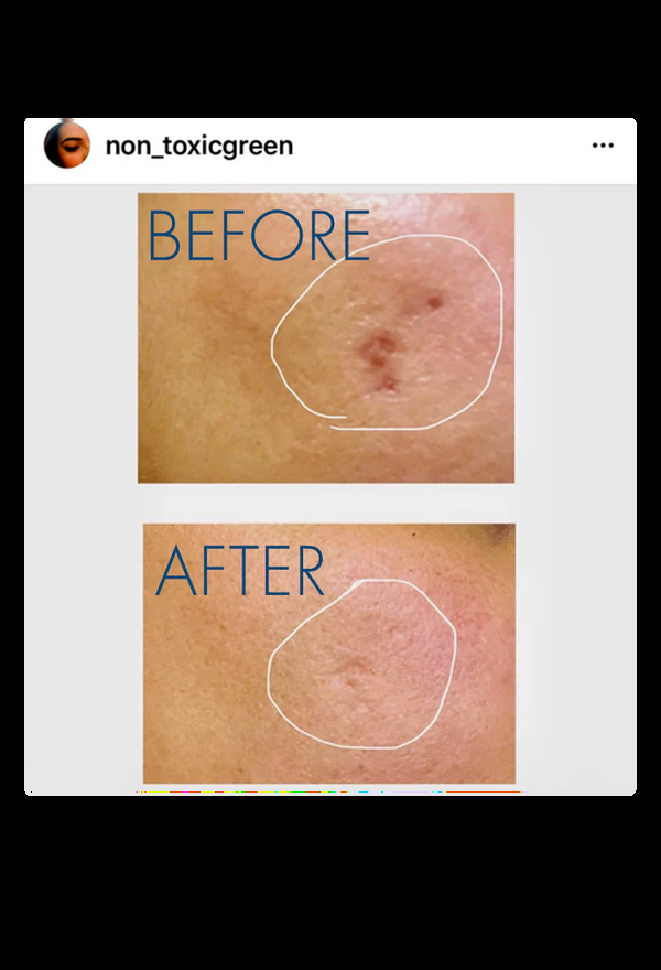 lily lolo Bluh Alchemy Multi C Serum