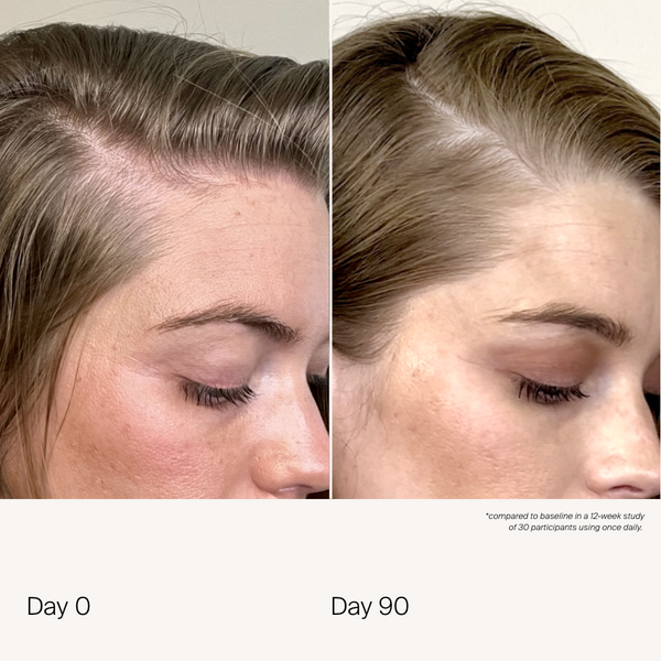 Living Proof Scalp Care Density Serum 3-Pack