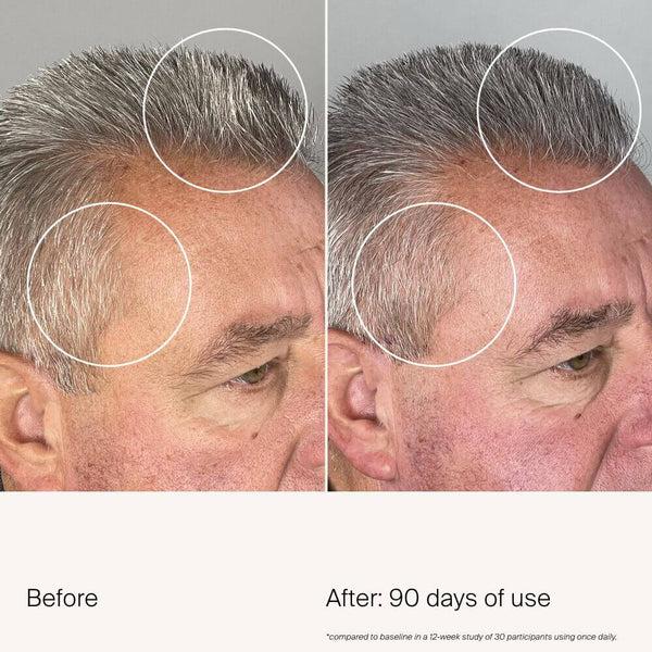 Living Proof Scalp Care Density Serum 3-Pack
