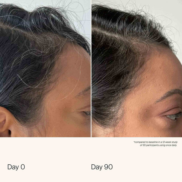 Living Proof Scalp Care Density Serum 3-Pack