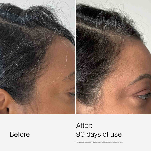 Living Proof Scalp Care Dry Scalp Treatment