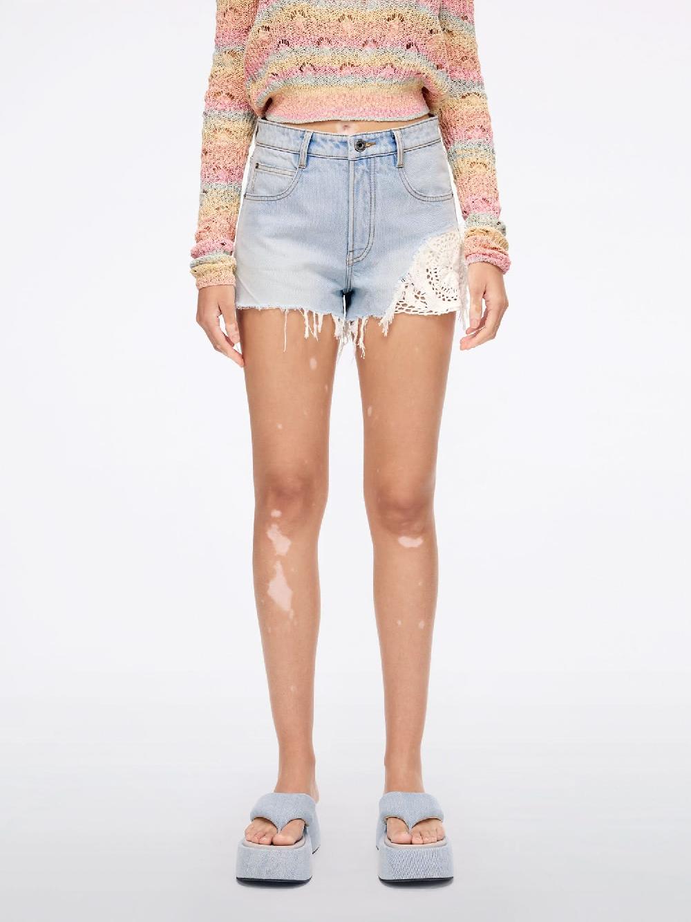 miss sixty PATCHWORK DENIM SHORTS LIGHT BLUE