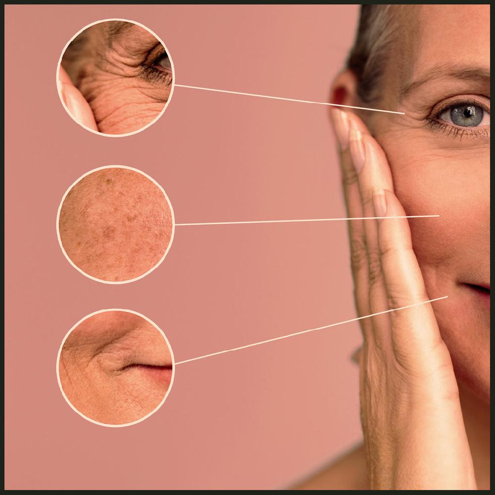 Natural Elements Astounding Products Suitable For Pigmentation And Sun Damaged Skin