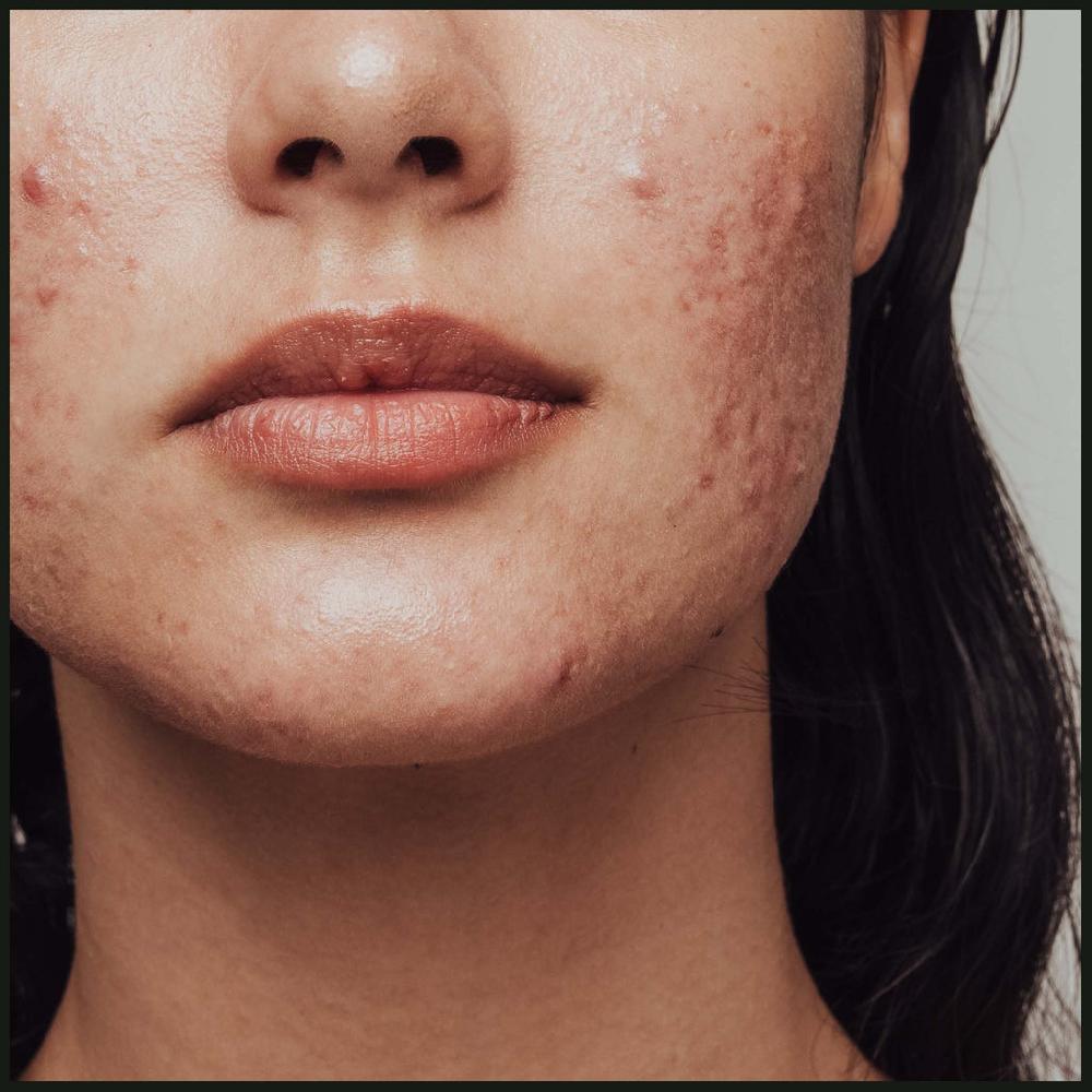 Natural Elements Next Level Calming And Clearing For Congestion