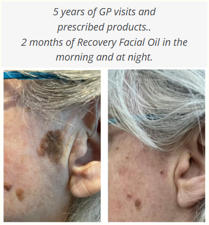 Natural Elements Recovery Facial Oil 50ml | Hormonal Menopausal Deep Repair Pigmentation Sun Damage | NES025