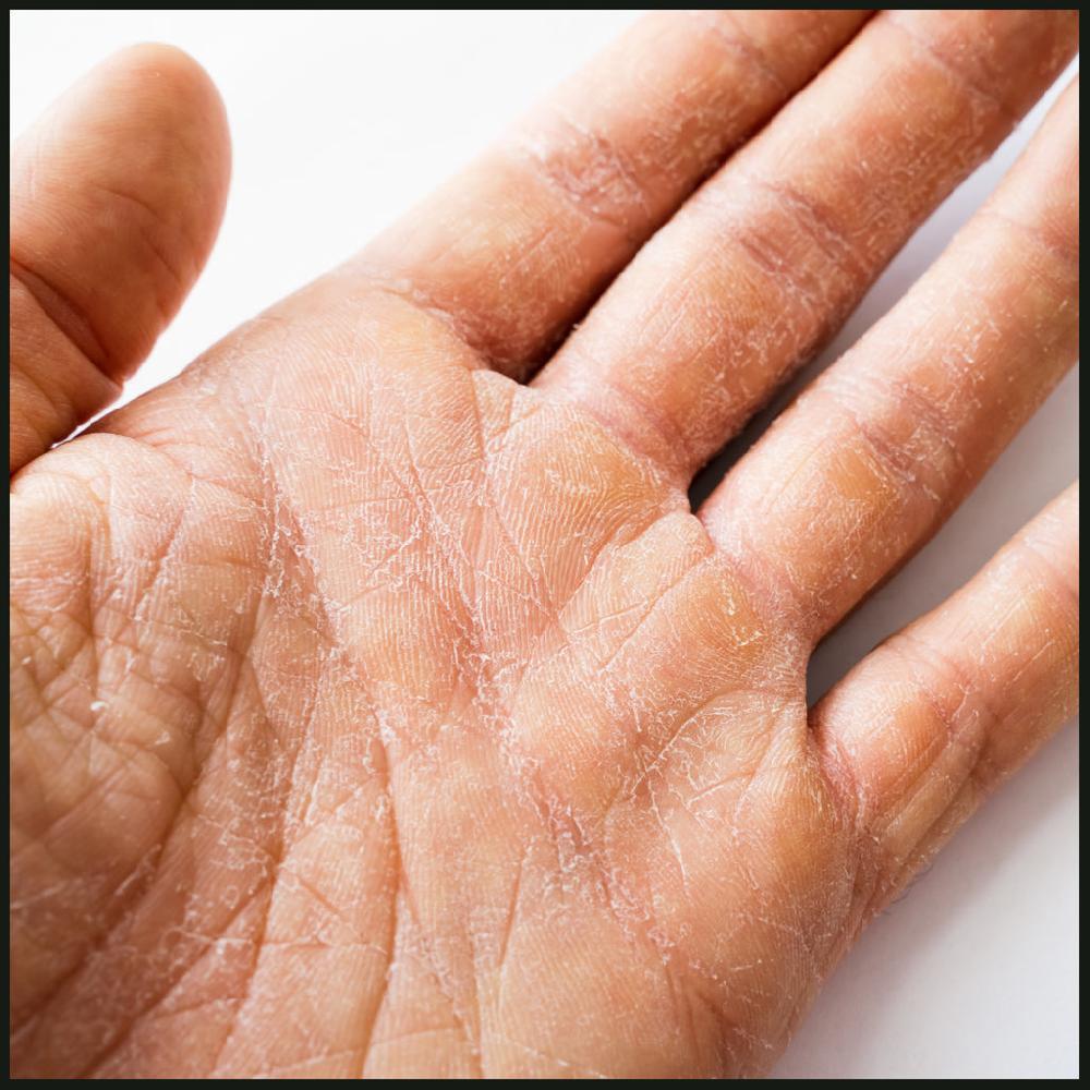 Natural Elements Soothing For Skin Irritation And Aids A Wide Variety Of Healing