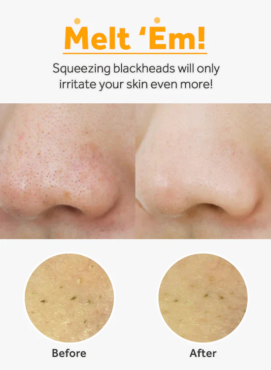 Nature Republic [MA:NYO] PURE CLEANSING OIL 200ml