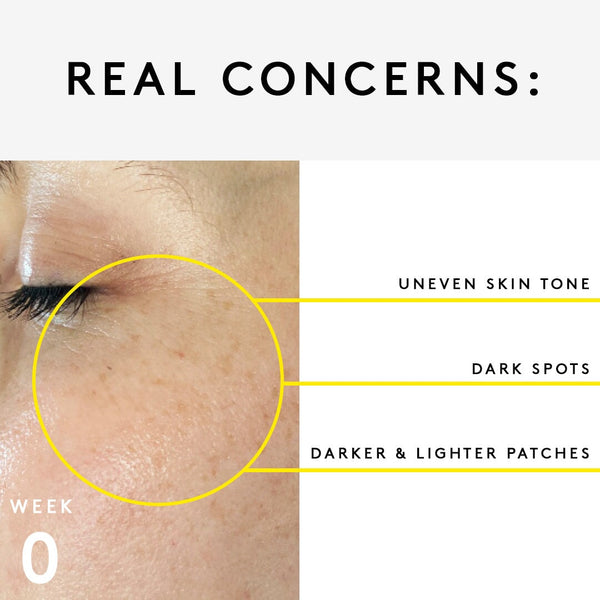 Nuori Essential Trio For Dark Spots