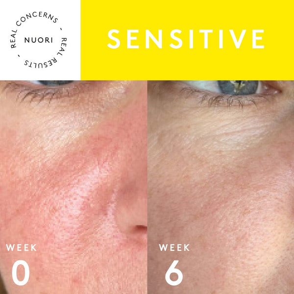 Nuori Essential Trio For Sensitive Skin