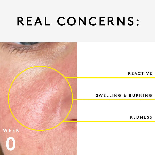 Nuori Essential Trio For Sensitive Skin