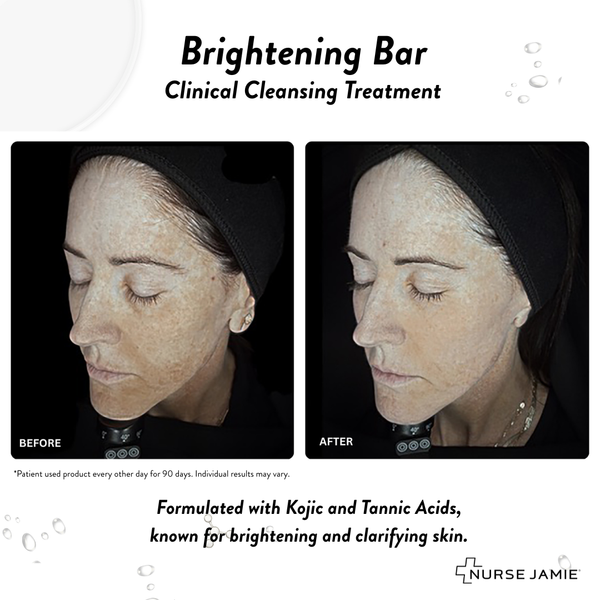 nurse Jamie Brightening Bar