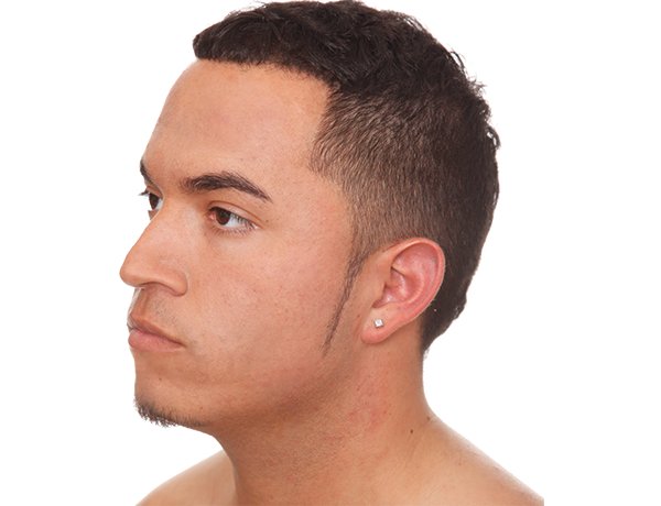 Nurse Jamie Dermalase™ AHA Mask