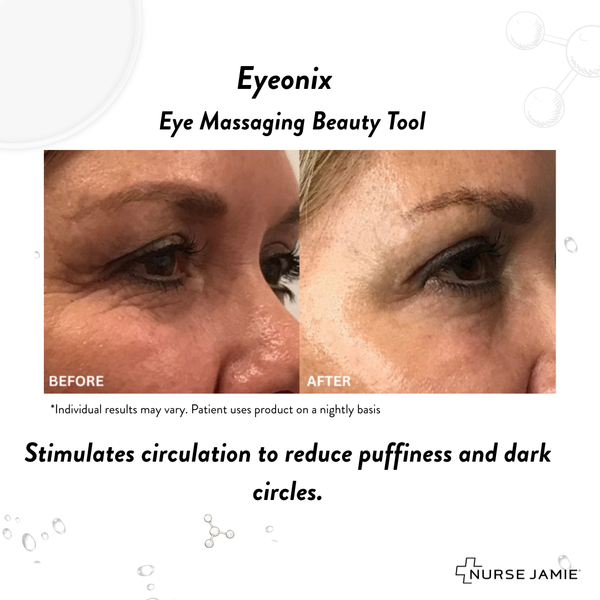 Nurse Jamie Eyeonix®