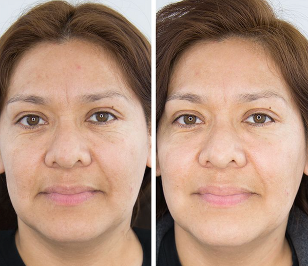 Nurse Jamie HydraTight™