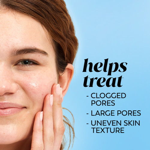 Olay Olay Gentle Exfoliating Toner Shrinks Appearance Of Pores