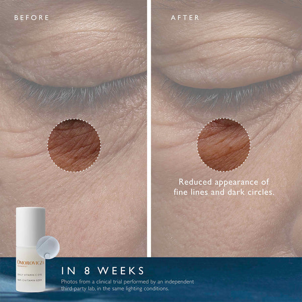 Omorovicza Daily Vitamin C Eye