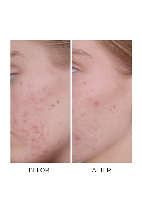 oskia MSM Bio-Plus Supplement