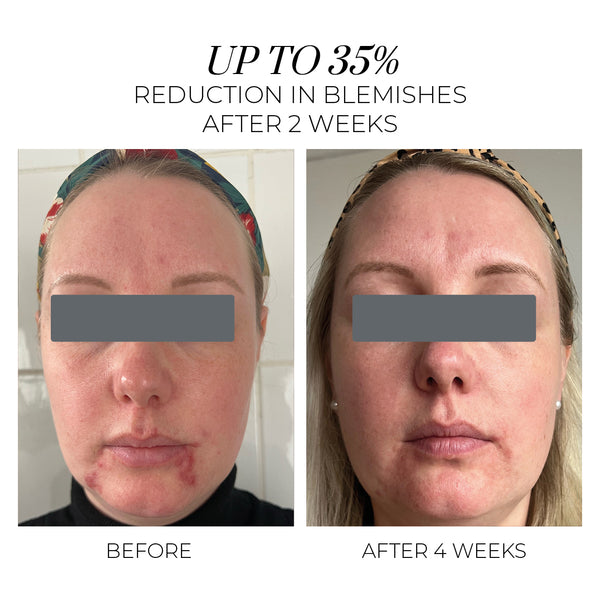 Oskia Violet Water Clearing Cleanser