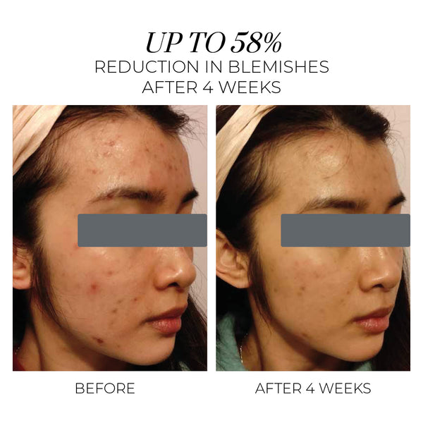 Oskia Violet Water Hydra-Gel