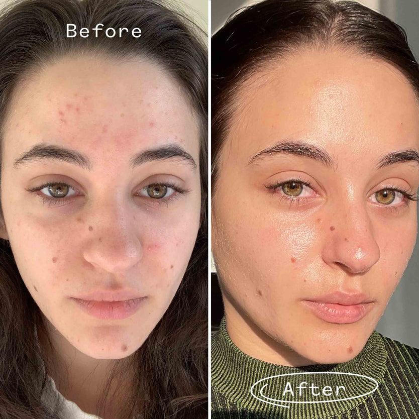 Pai Skincare Carbon Star™ Face Oil