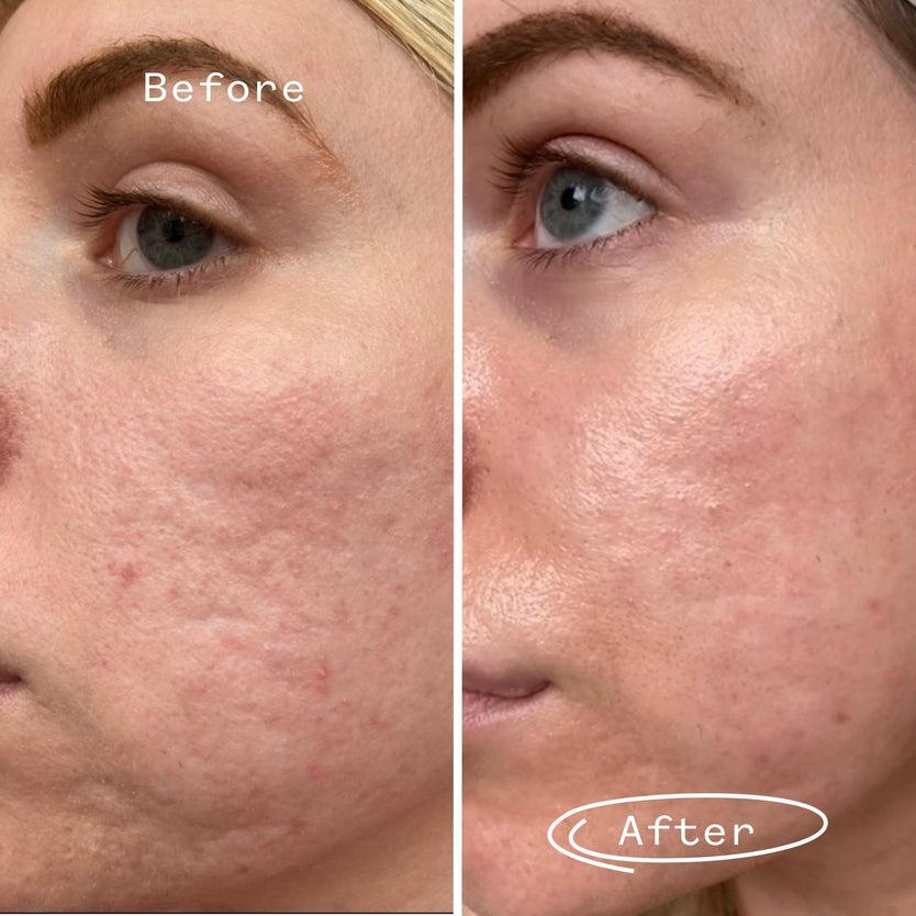 Pai Skincare Hyaluronic Acid 0.3% Hydrating Booster