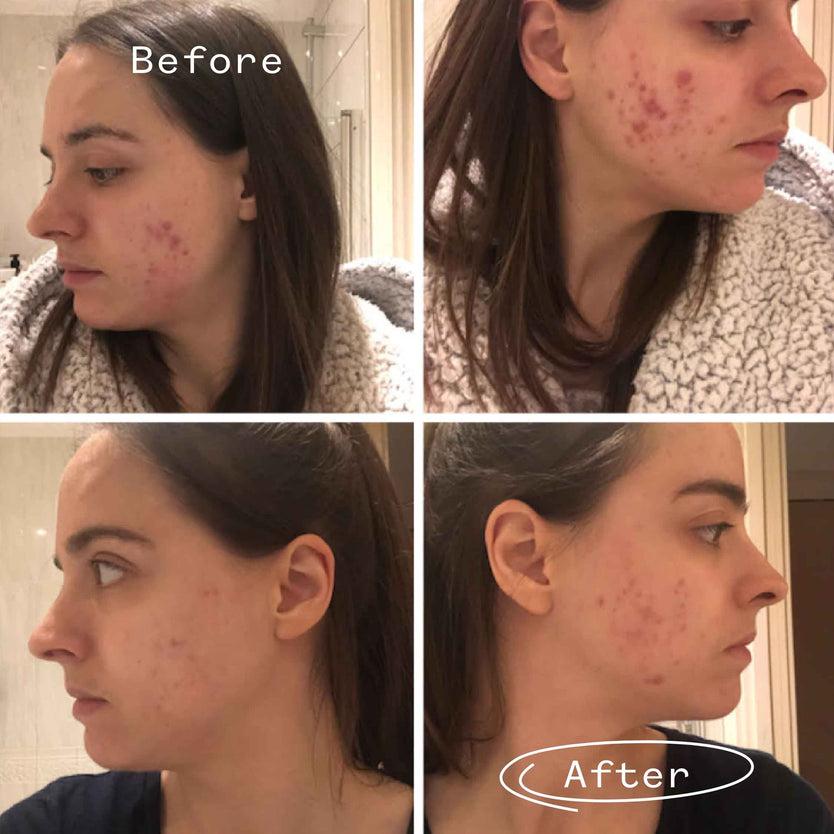 Pai Skincare Instant Kalmer™ Serum