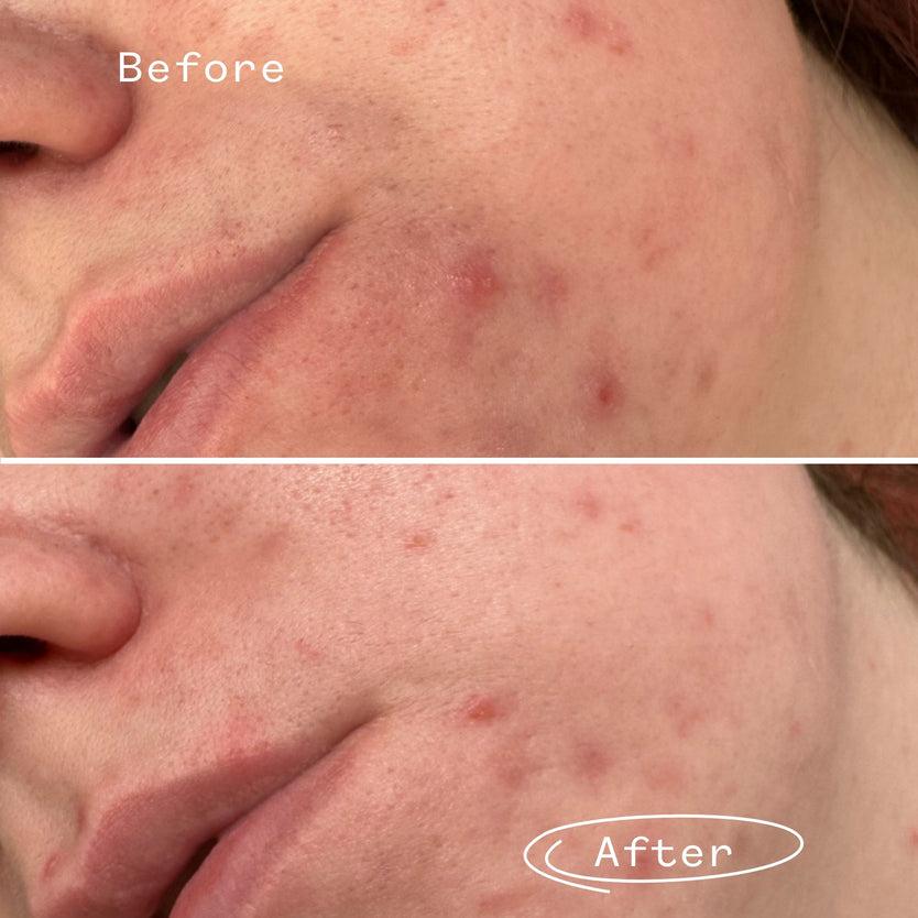 Pai Skincare Phaze™ Gel Cleanser