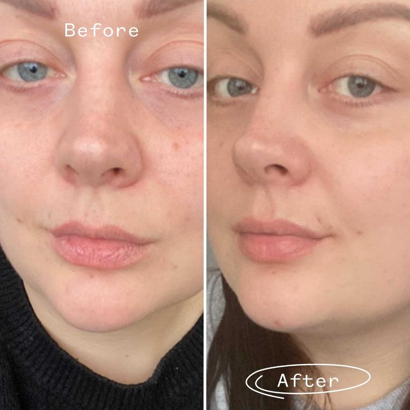 Pai Skincare Rosehip Bioregenerate™ Face Oil Mini