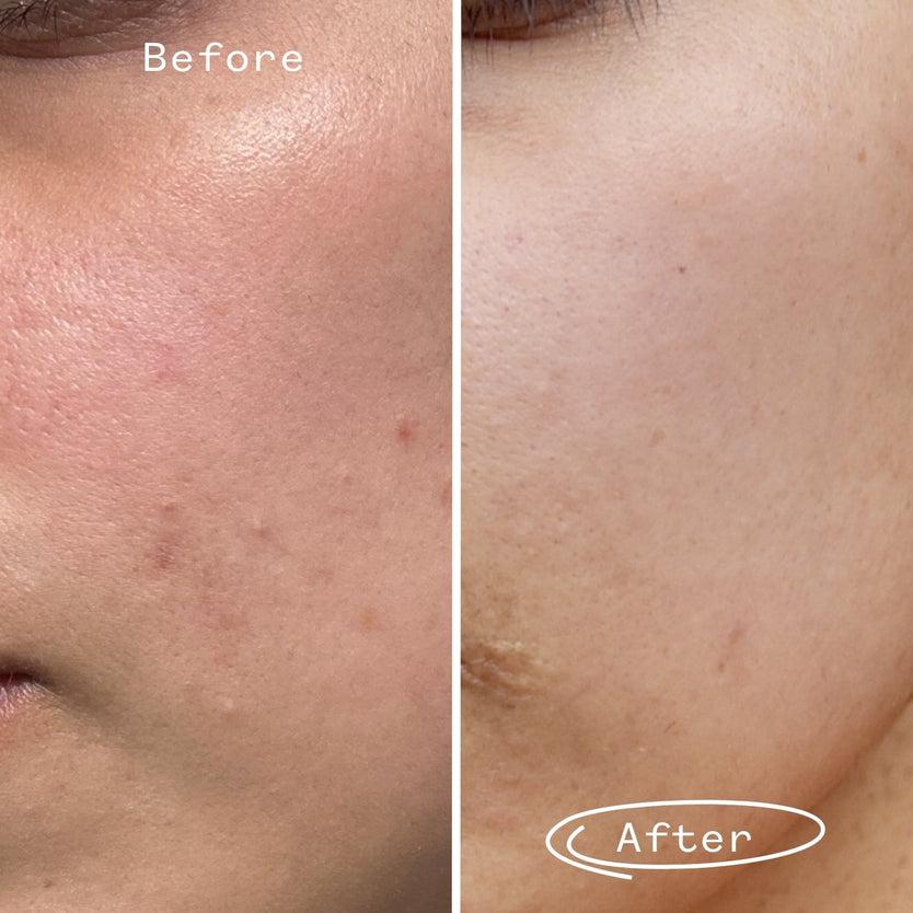 Pai Skincare Tri-Mushroom 10% Super-Soothing Booster