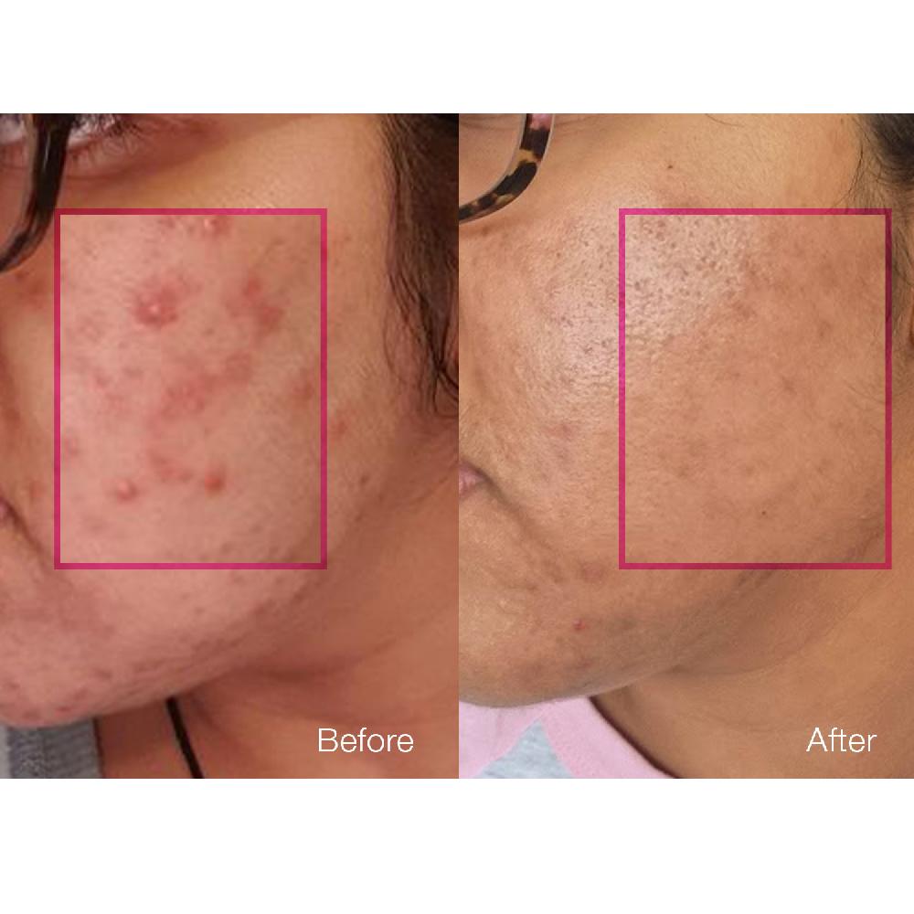 Pestle & Mortar Clarify 2% BHA Salicylic Toner - 80ml / 2.71 FL OZ