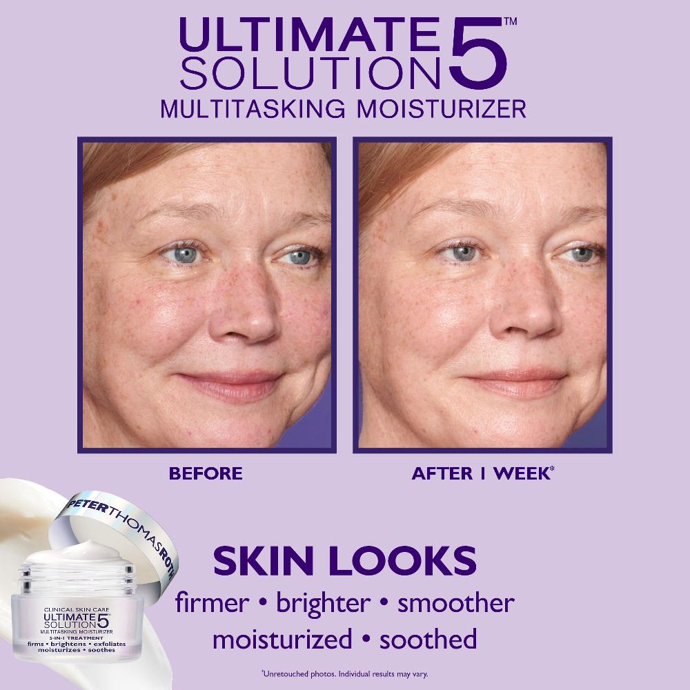 Peter Thomas Roth Brightening & Beyond 3-Piece Kit For Glowing Skin