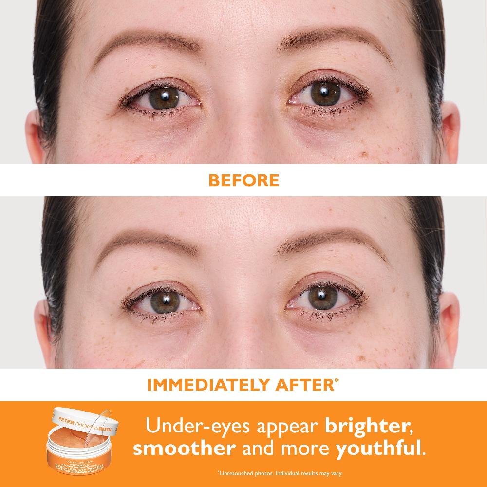 Peter Thomas Roth Full-Size Vitamin C & Hyaluronic Eye Patches 2-Piece Kit