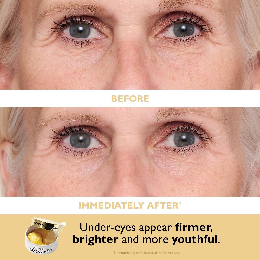 Peter Thomas Roth 24K Gold Glow-Up 2-Piece Kit