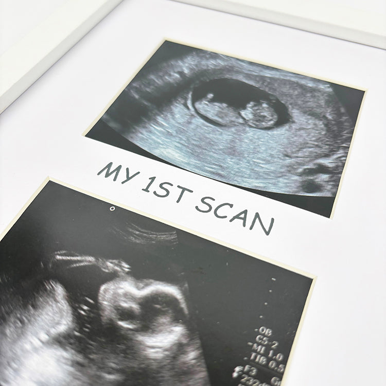 Photoframesandart My First Scan Photo Frame | White
