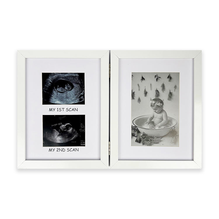 photoframesandart My First Scan Photo Frame | White