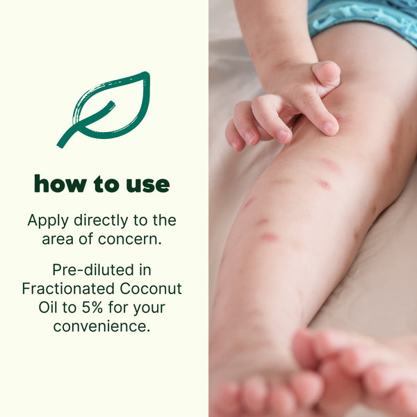 Plant Therapy Itch Away Essential Oil Pre-Diluted Roll-On