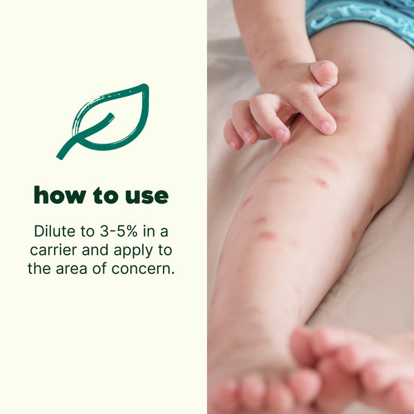 Plant Therapy Itch Away Essential Oil